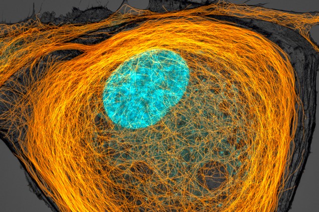 7º lugar: Em laranja, os microtúbulos – filamentos de proteína – das paredes de uma célula. Em azul, o seu núcleo.