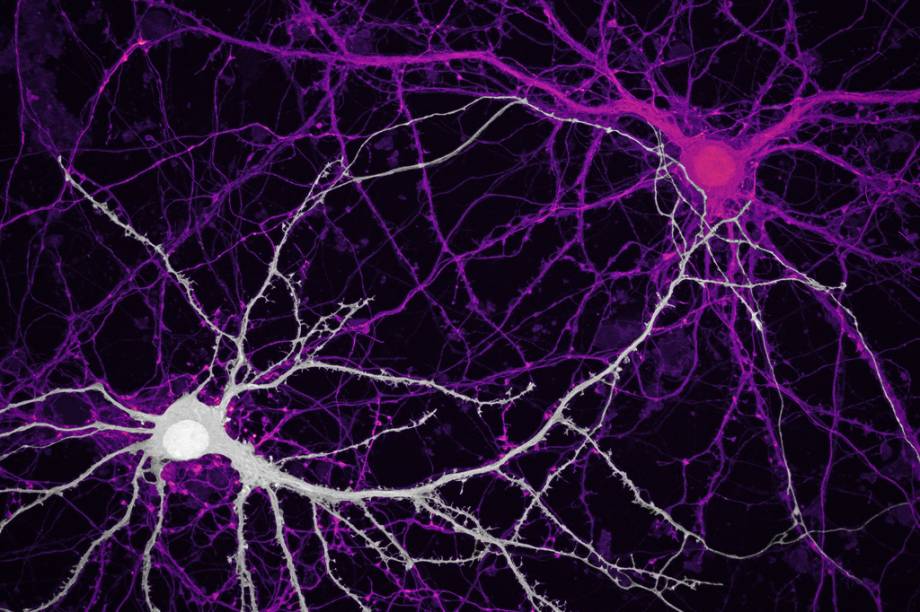 9º lugar: As conexões entre neurônios do hipocampo, região do cérebro humano ligada às emoções e à memória. 9º lugar: As conexões entre neurônios do hipocampo, região do cérebro humano ligada às emoções e à memória.