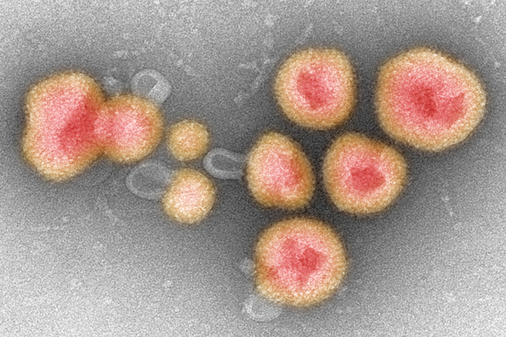 Pesquisadores confirmam transmissão entre humanos do vírus Chapare