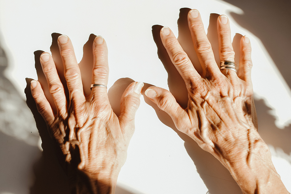 Duas mãos com as veias ressaltadas em uma superfície branca, recebendo a luz do sol.