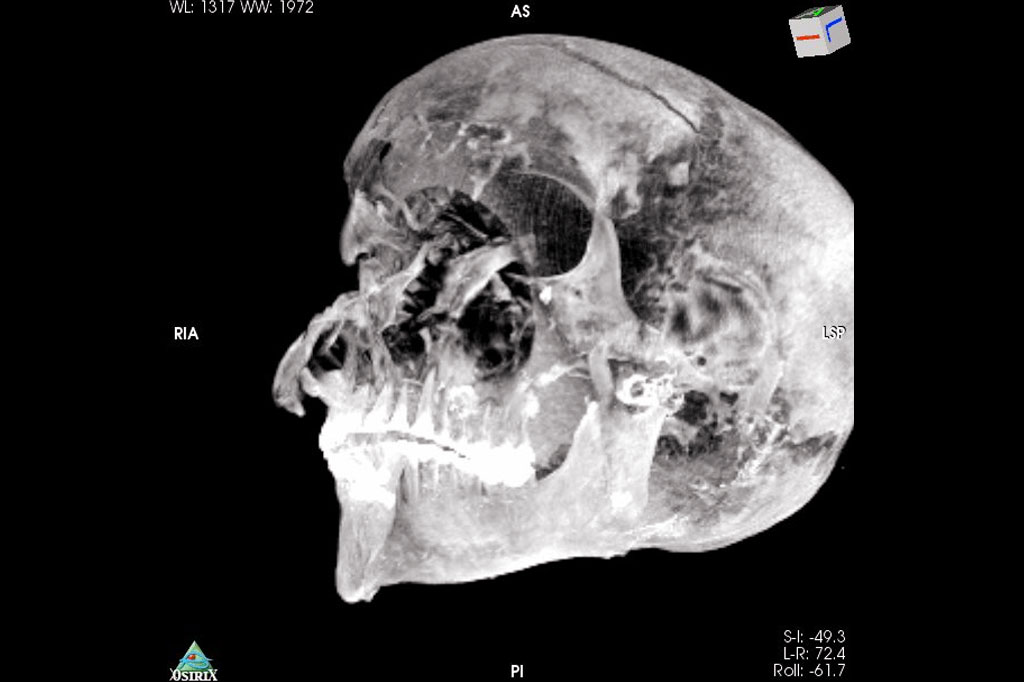 Imagem 3D do crânio do faraó.