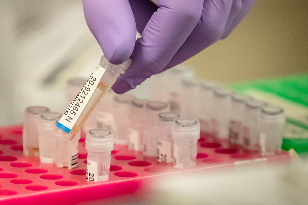 Edição genética da Síndrome de Down levanta questões controversas sobre eugenia e ética