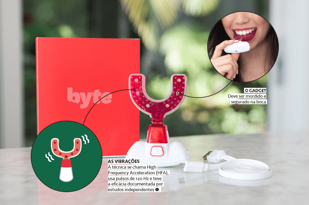 Dispositivo Byte para alinhamento dental.