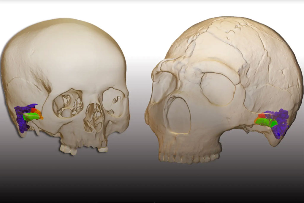 Imagem 3D de dois crânios.