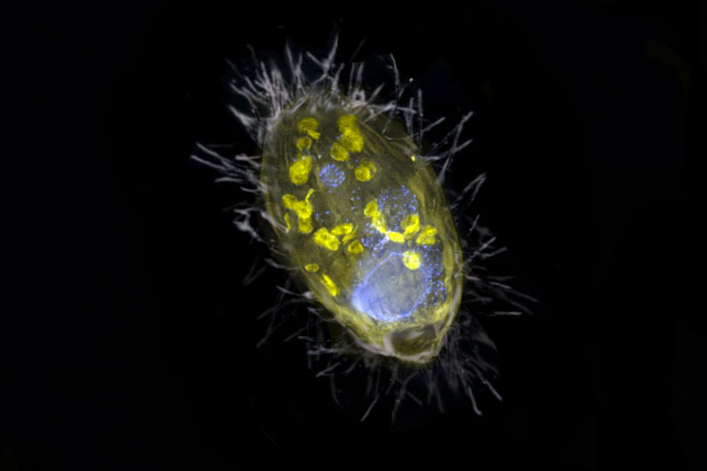 Ilustração do endossimbionte 'Candidatus Azoamicus ciliaticola' e seu hospedeiro