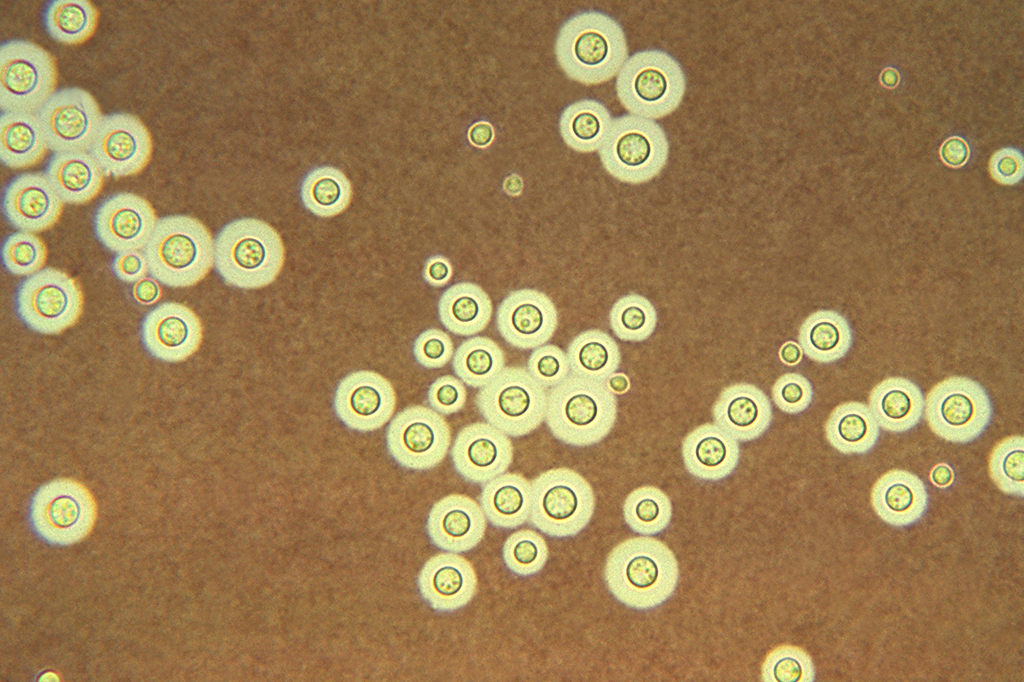 Foto microscópica exibindo o fungo Cryptococcus neoformans.
