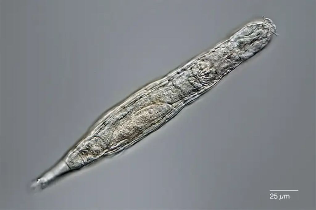 Imagem microscópica de rotífero revivido depois de 24.000 anos em permafrost.
