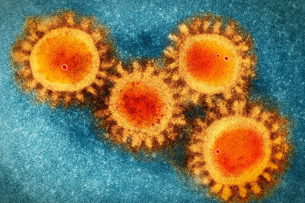 Visualização colorida da microscopia eletrônica do coronavírus.