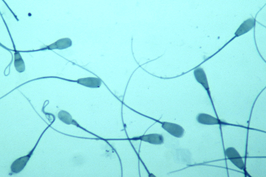 Visão de microscópio de espermatozoides.