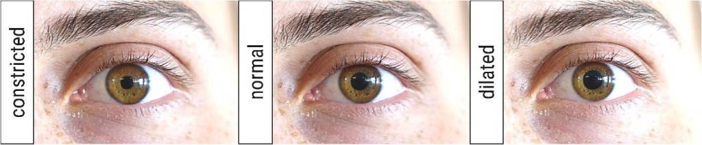 Alemão de 23 anos é capaz de contrair e dilatar as pupilas dos olhos, mostra estudo 2 Foto do olho de D.W. controlando sua pupila.