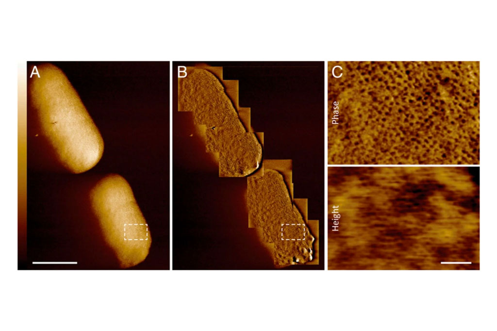 Imagem de microscópio da bactéria E. coli.
