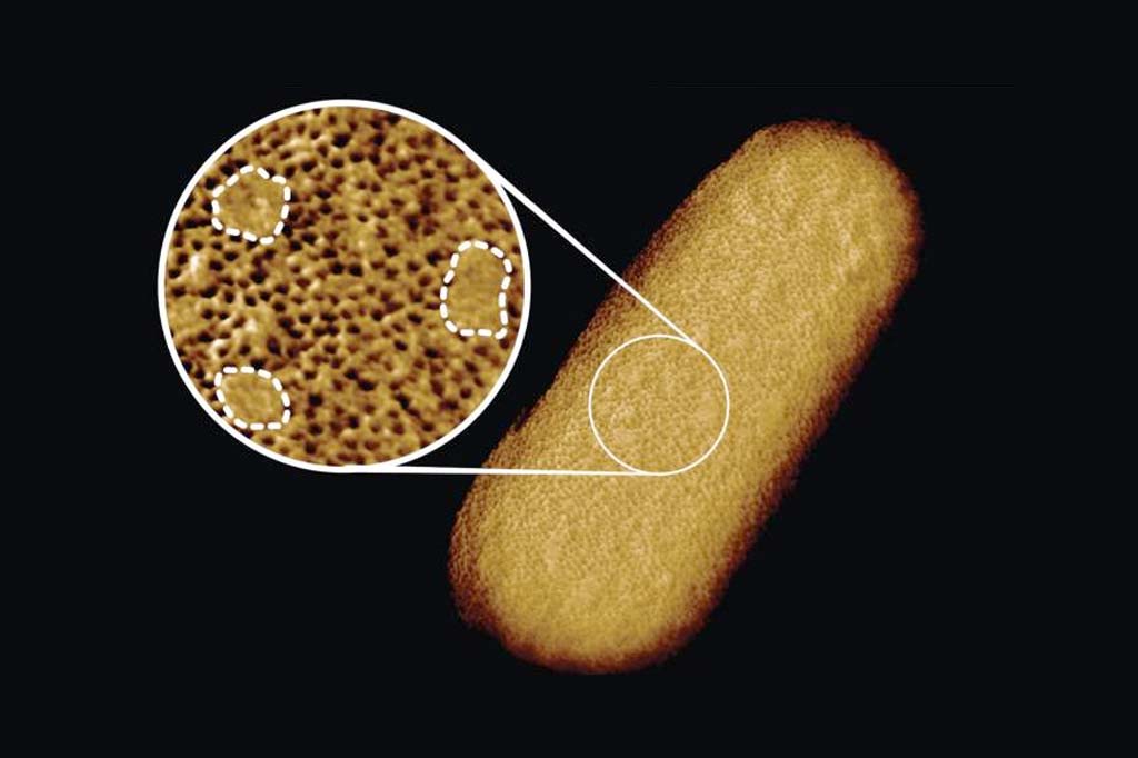 Imagem de microscópio da bactéria E. coli.