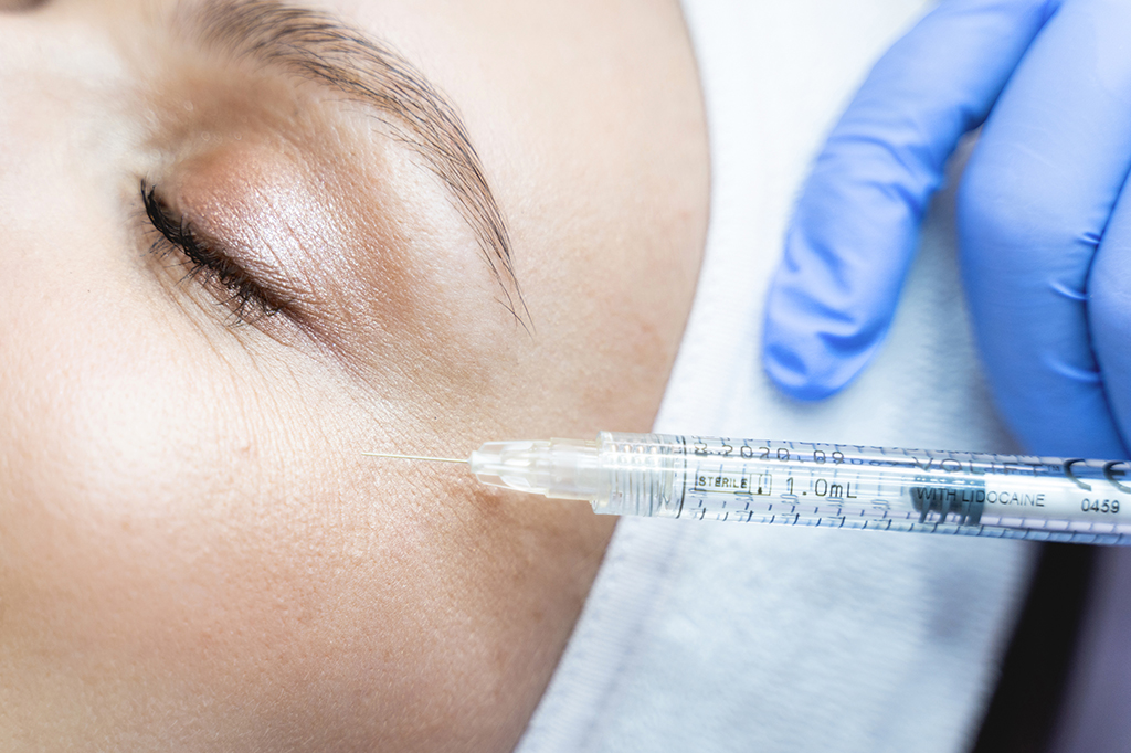 Injeção de botox sendo aplicada.