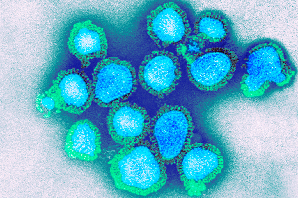 Vírus da H3N2.