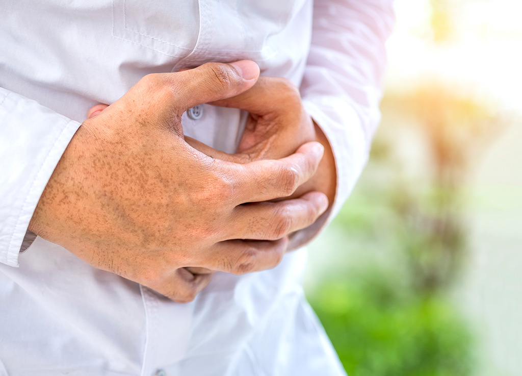 Obstrução intestinal pode matar?