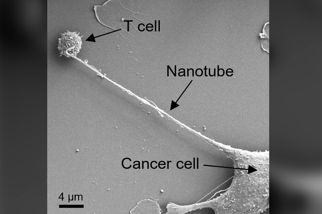 Imagem microscópica de célula cancerígena "grudando" tentáculo em célula T.