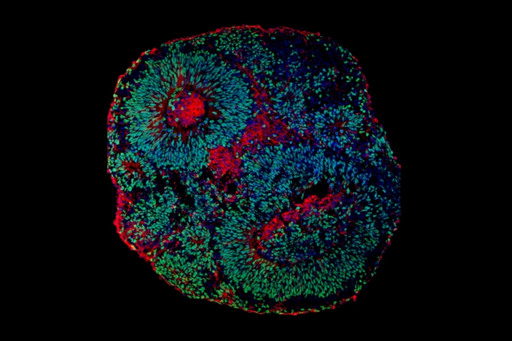 Imagem de microscopia mostrando o aspecto de um organoide cerebral derivado de células humanas. As células em verde são os progenitores de neurônios e as células em vermelho são os neurônios.