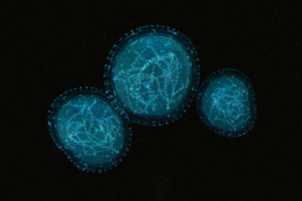 Imagem laboratorial do vírus da varíola de macaco.