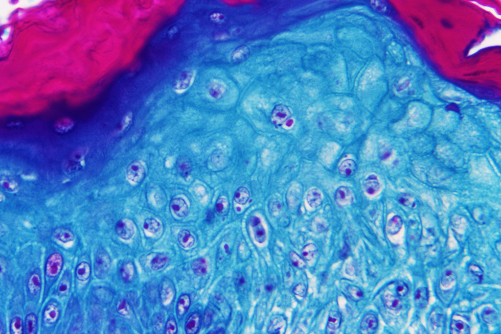 Varíola dos macacos: Brasil confirma primeiro caso da doença no país