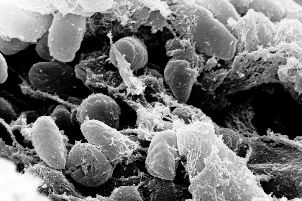 Imagem microscópica da bactéria Yersinia pestis.