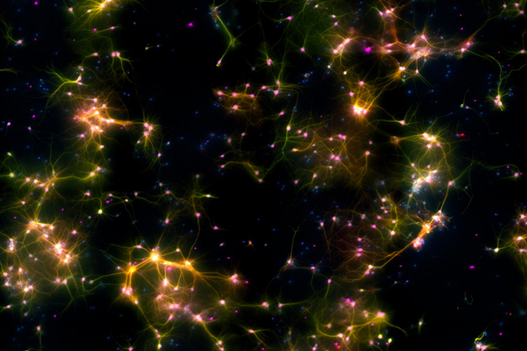 Imagem de microscópio de células neurais.