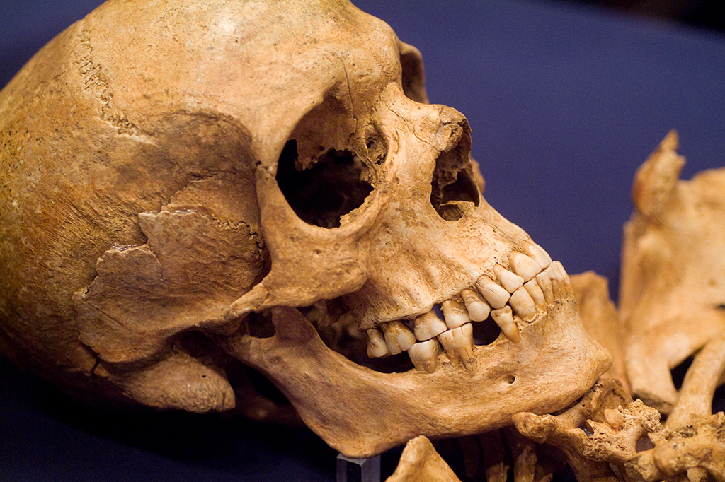 Fotografia de um crânio e outros restos mortais.
