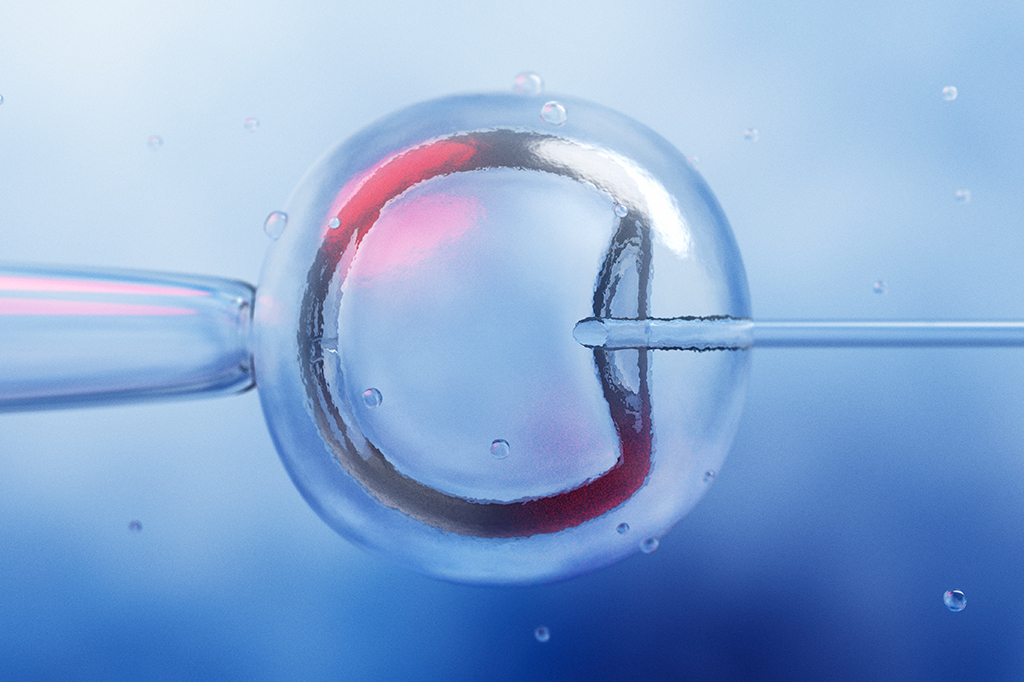 representação de inseminação artificial ou fertilização in vitro.