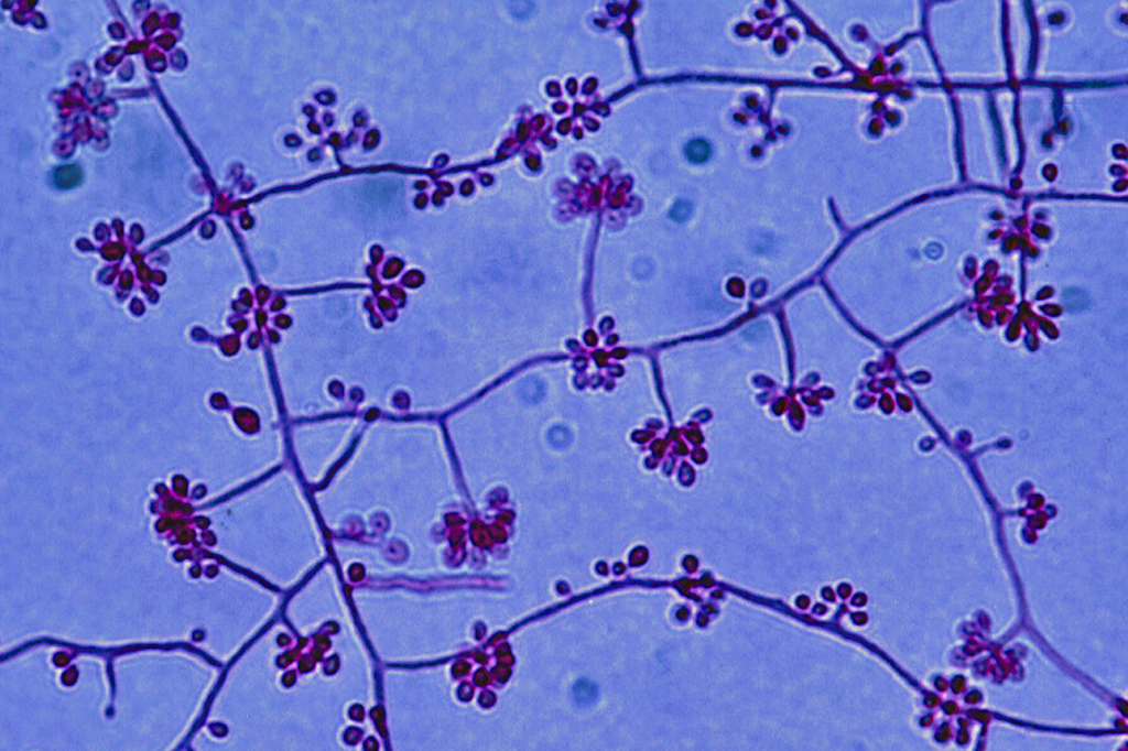 Imagem do fungo Sporothrix schenckii, causador da esporotricose.