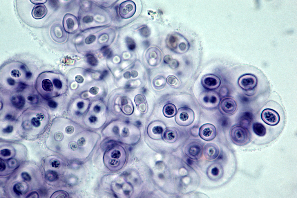 Foto de cianobactérias aproximada por microscópio.
