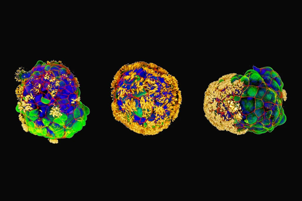 Feito com células humanas, antrorrobôs podem reparar tecidos