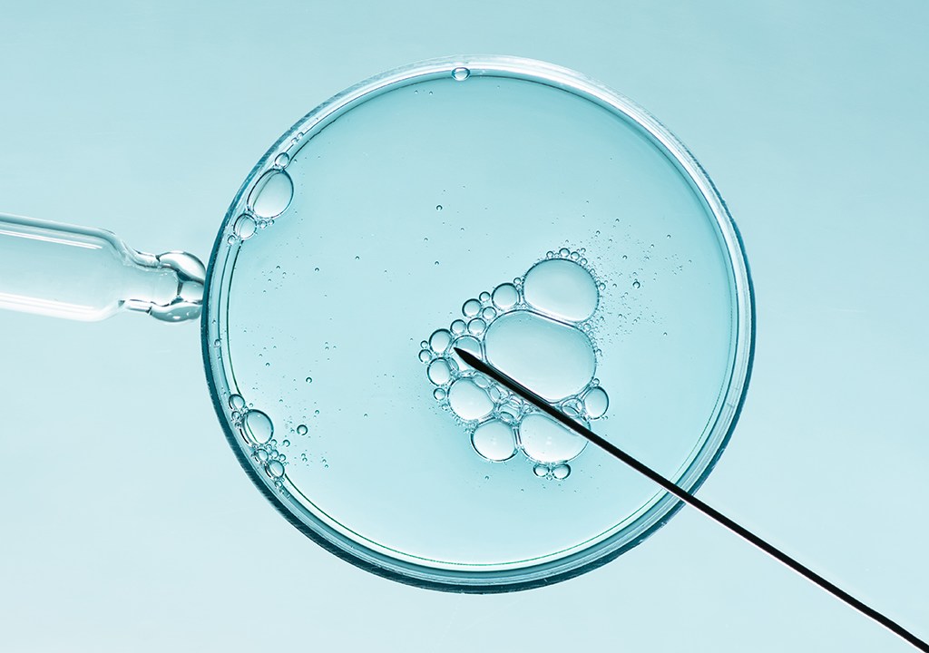 Fotografia do procedimento de fertilização in vitro.