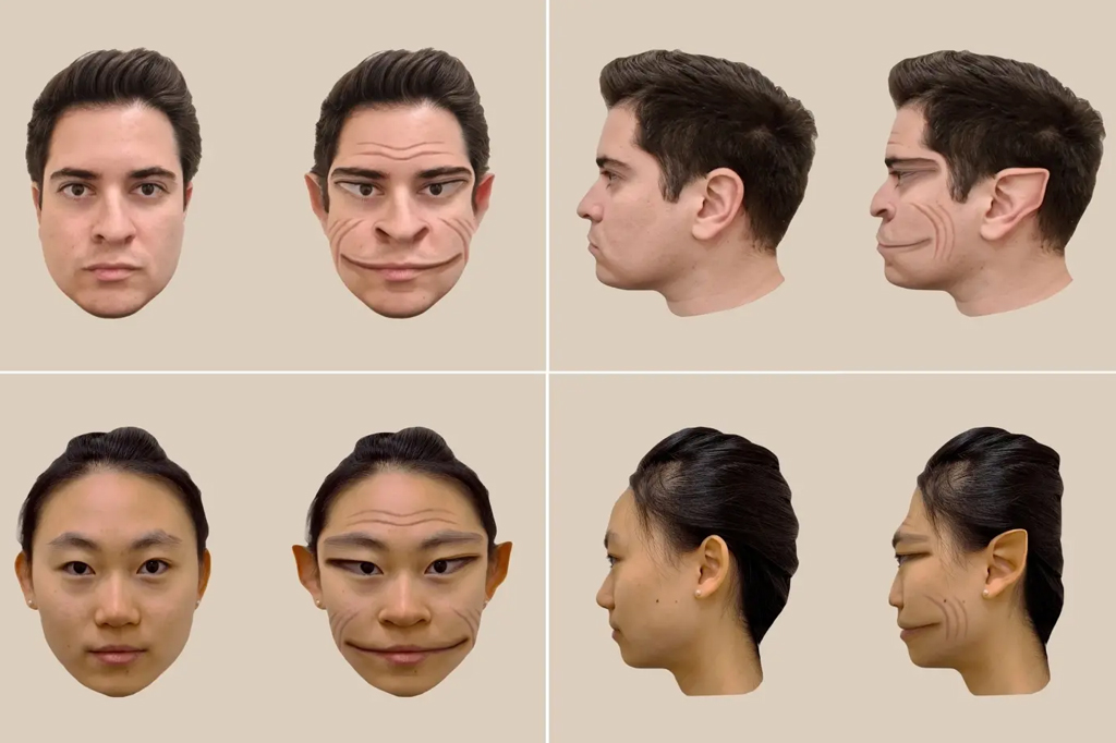 Imagens geradas por computador das distorções de um rosto masculino (acima) e de um rosto feminino, conforme percebidas pelo paciente.