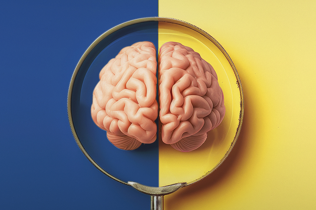 Estudo vê diferenças no cérebro de homens e mulheres