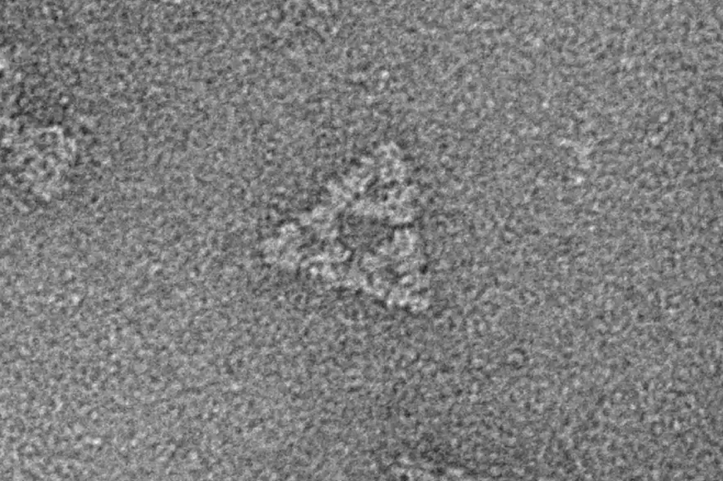 Imagem de microscópio eletrônico de uma estrutura fractal triangular composta de monômeros enzimáticos