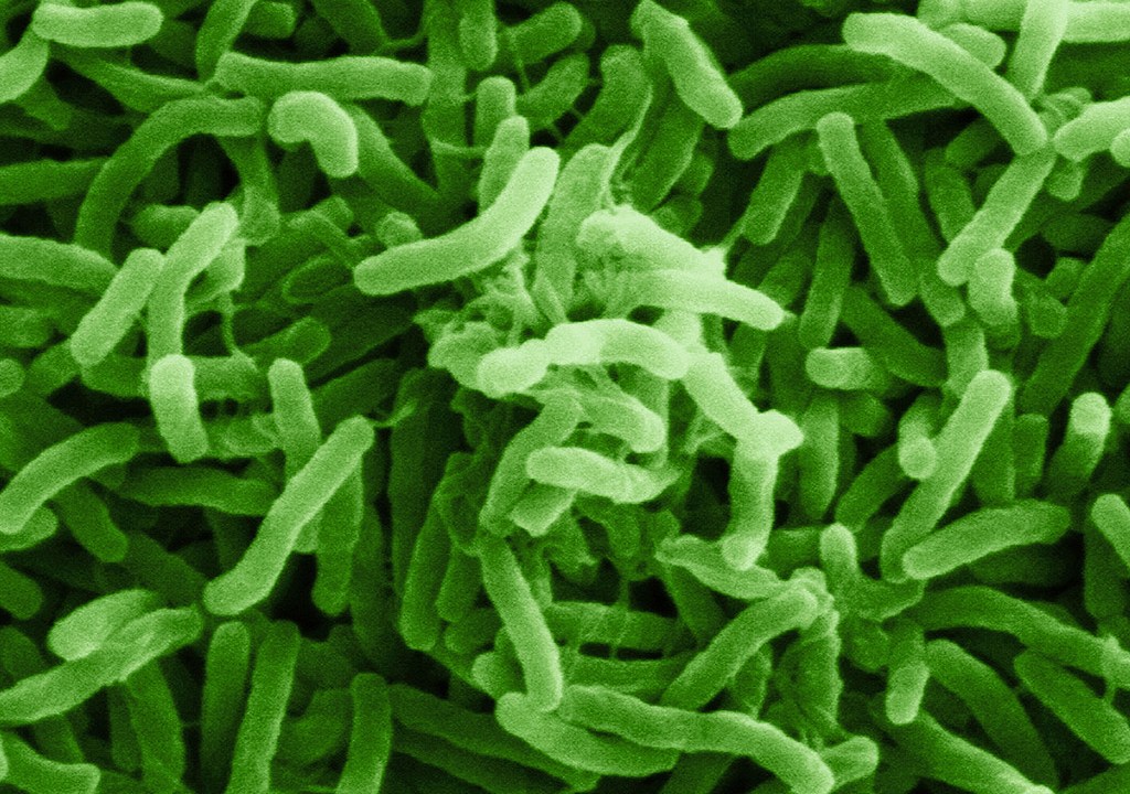 Micrografia eletrônica da bactéria do cólera.