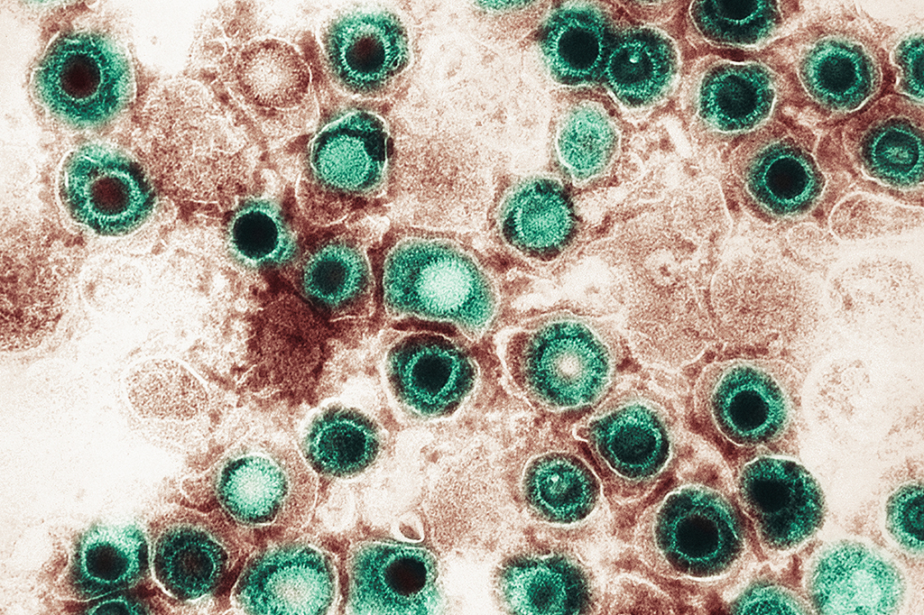 Imagem microscópica do vírus da herpes.