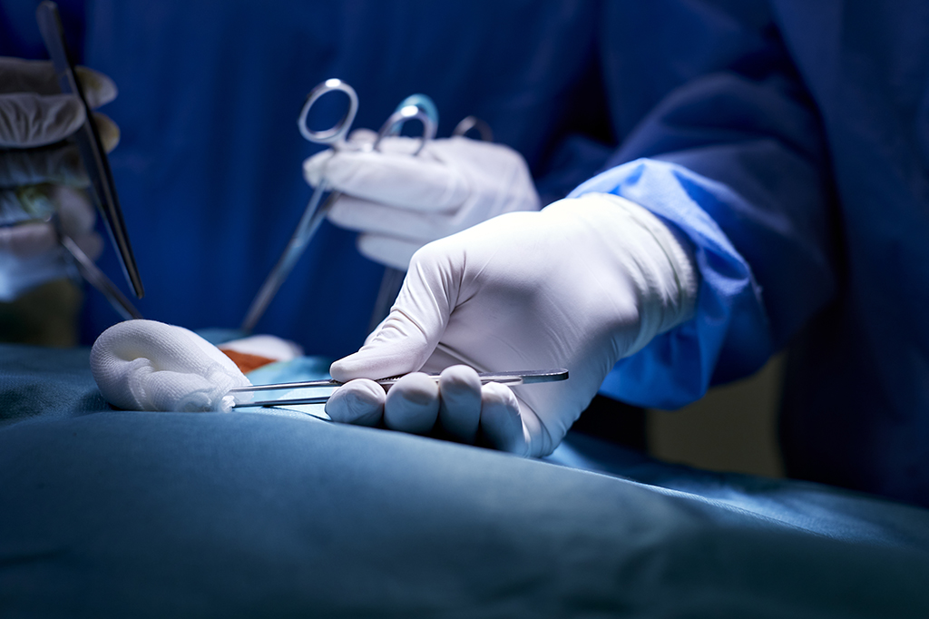 Xenotransplante: chinês é primeiro humano a receber um fígado de porco