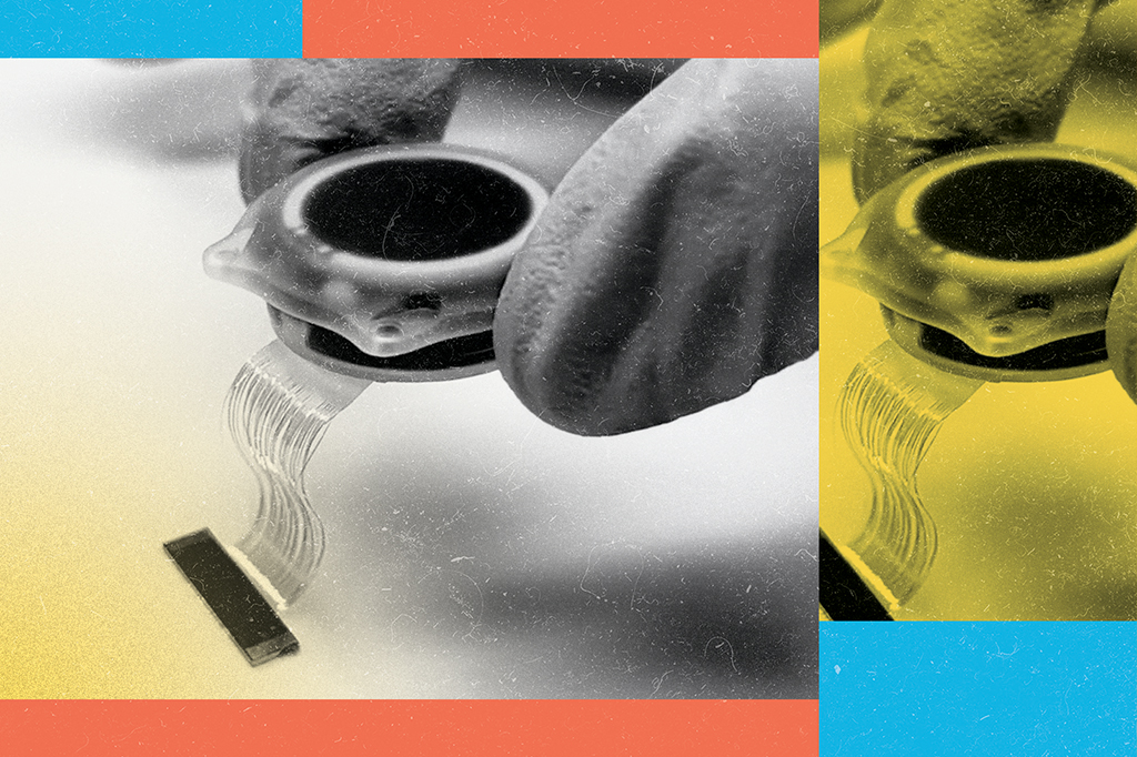 Neuralink admite problema em implante