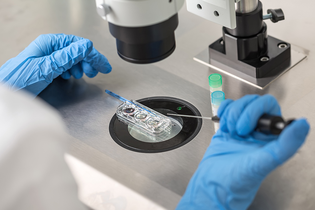 A poluição do ar pode diminuir as chances de nascimento após a fertilização in vitro em 38%