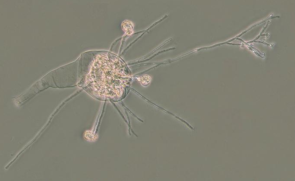 Rotíferos bdeloides visto em microscópico.