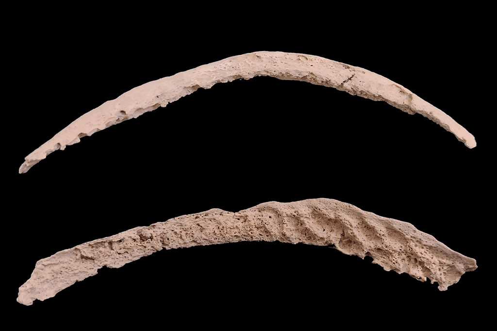 Ossos de 9 mil anos podem explicar origem da sífilis