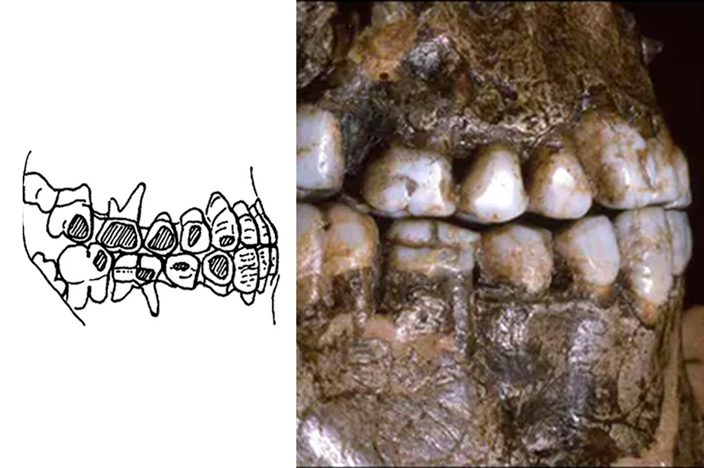 Há 30 mil anos, piercing na bochecha era a moda entre os europeus da era do gelo
