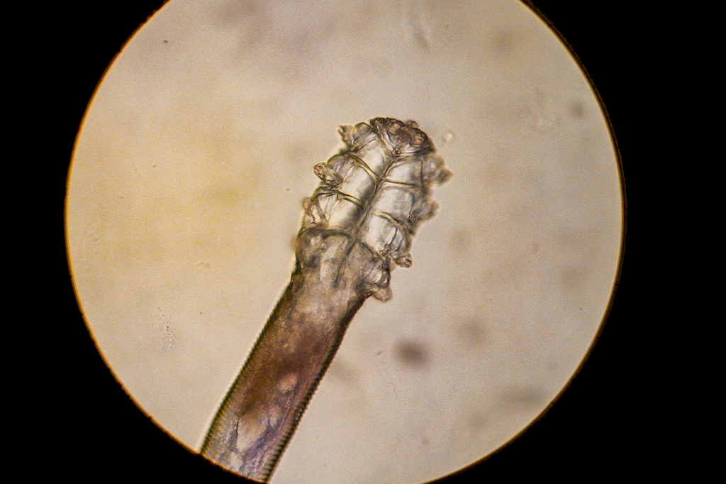 1903-Demodex-layout_site1 Fotografia de um Demodex folliculorum - ácaro parasita nos cílios de um olho humano.