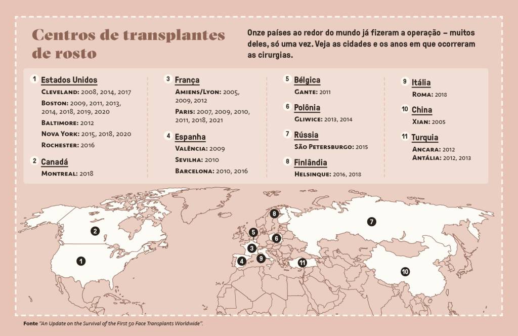 SI_475_Transplante_de_face_4 Mapa, em fundo rosa, dos principais países que realizaram transplante de rosto.