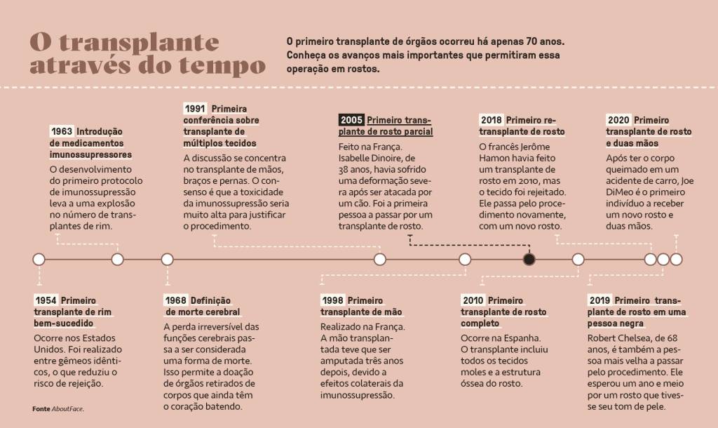 SI_475_Transplante_de_face_6 Gráfico, em fundo rosa, com uma linha do tempo mostrando os avanços dos transplantes de rosto.