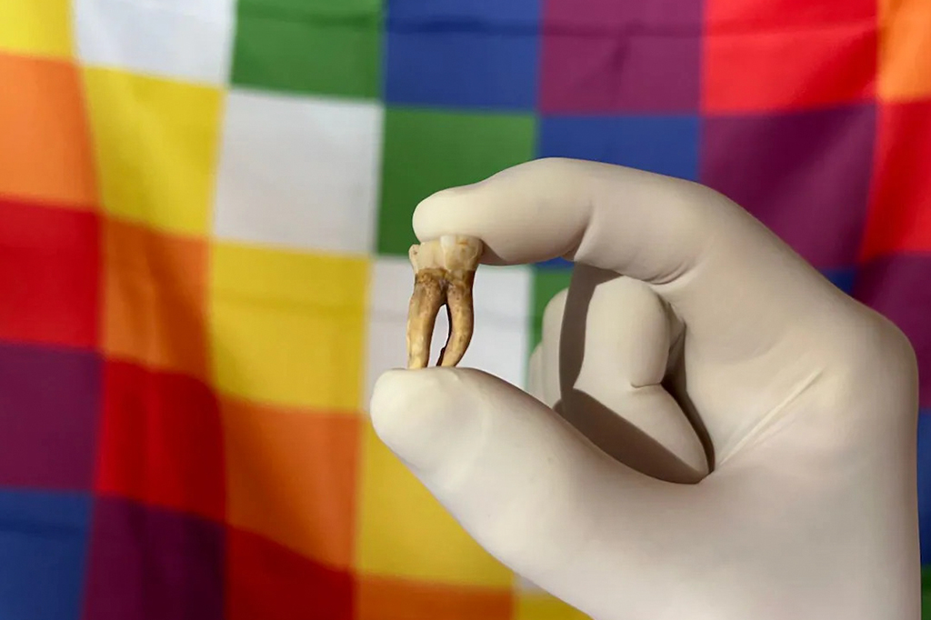 Lepra se espalhou pelas Américas bem antes da chegada dos europeus