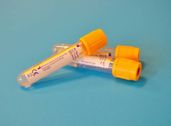 Fotografia de ampolas de sangue.