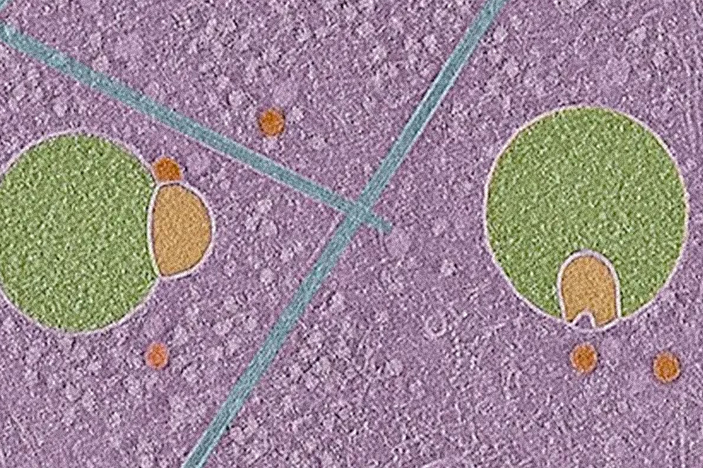 As estruturas verde e laranja nesta imagem são hemifusomos, organelas recém-descobertas que podem representar um caminho até então desconhecido para a reciclagem em células humanas.
