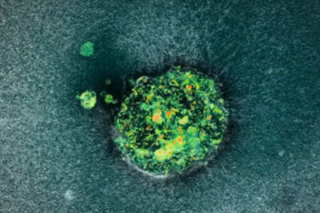 Pela primeira vez, cientistas registram momento em que embrião humano se fixa no útero