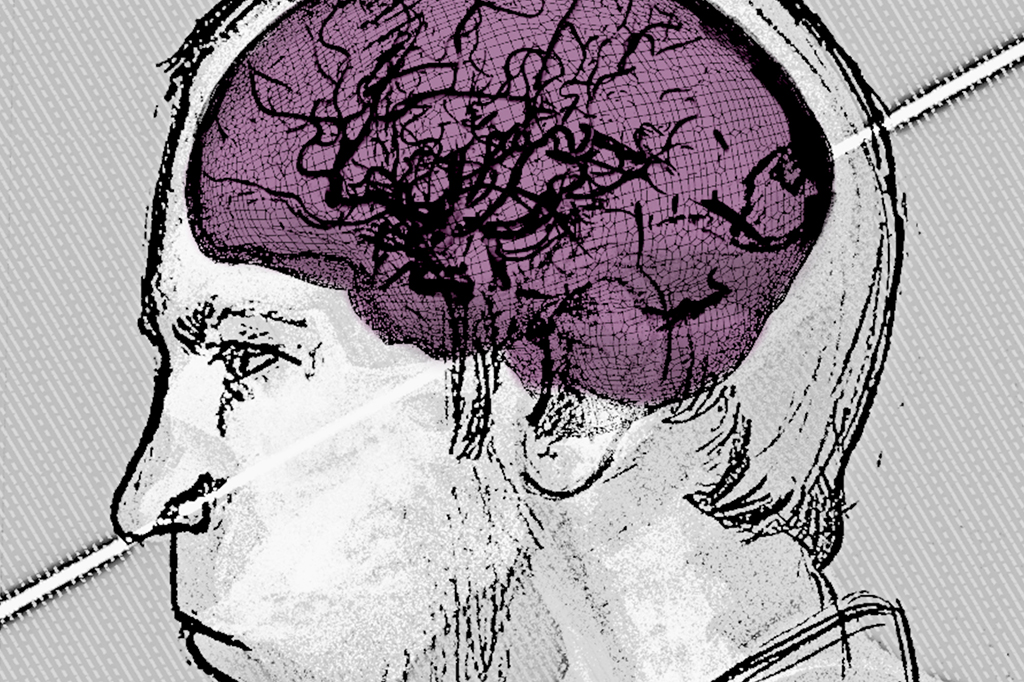Reconstrução digital mostra como feixe de prótons atravessou cérebro de físico soviético